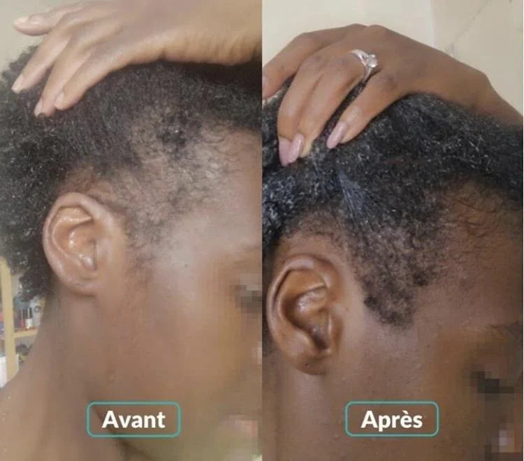 Kifaya - Huile Pousse Cheveux Naturelle