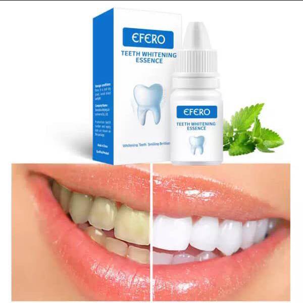 Kifaya - WhiteSmile Pro Blanchisseur de Dent