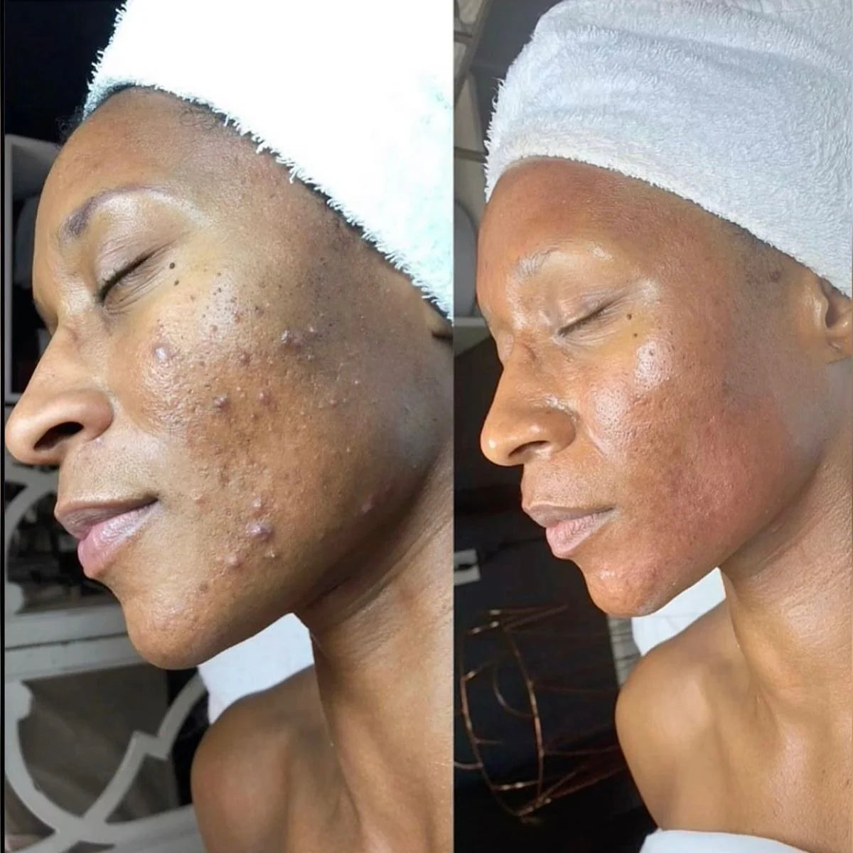 Kifaya - Crème Réparatrice Anti-Cicatrices & Vergetures