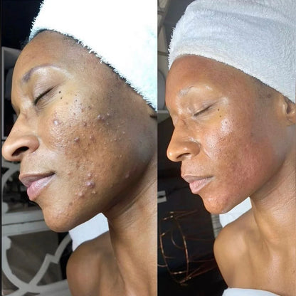 Kifaya - Crème Réparatrice Anti-Cicatrices & Vergetures