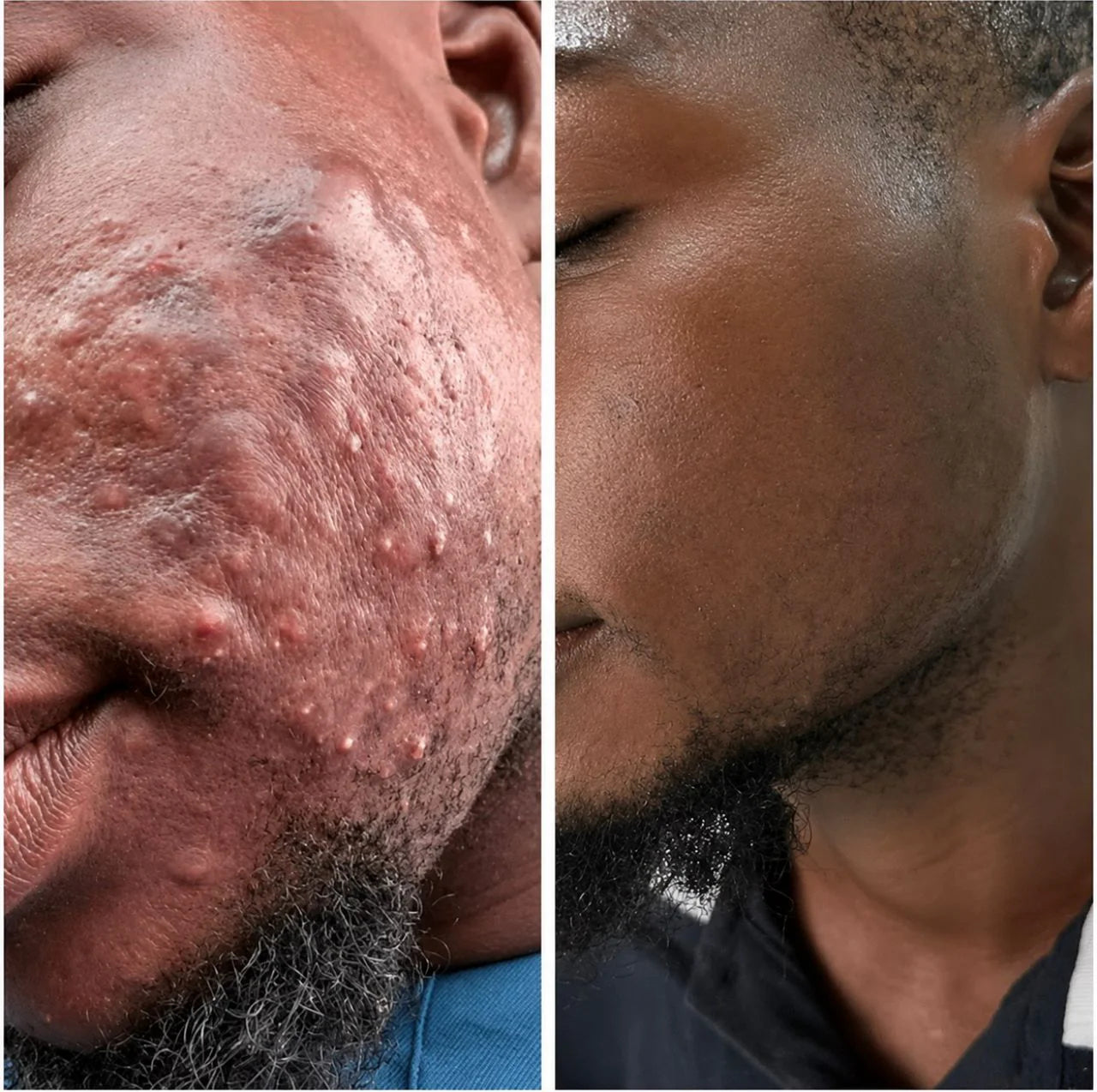 Kifaya - Crème Réparatrice Anti-Cicatrices & Vergetures