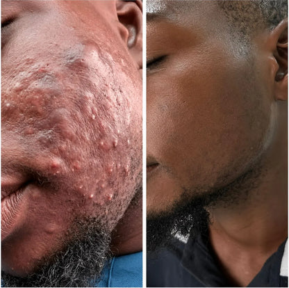 Kifaya - Crème Réparatrice Anti-Cicatrices & Vergetures