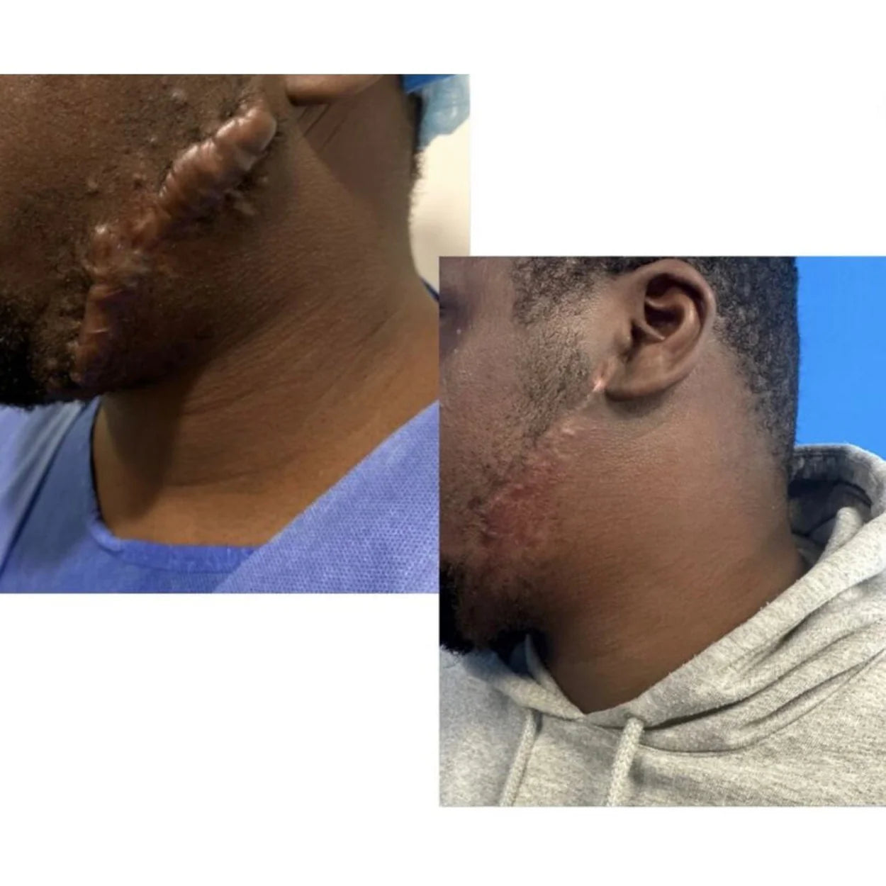 Kifaya - Crème Réparatrice Anti-Cicatrices & Vergetures