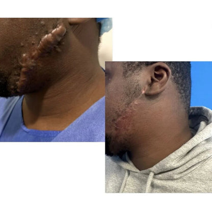 Kifaya - Crème Réparatrice Anti-Cicatrices & Vergetures