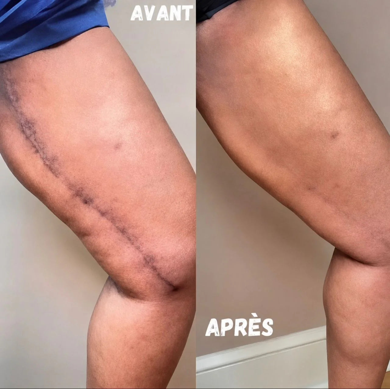 Kifaya - Crème Réparatrice Anti-Cicatrices & Vergetures