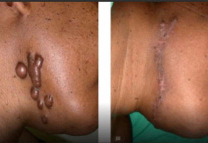 Kifaya - Crème Réparatrice Anti-Cicatrices & Vergetures
